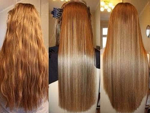 Tratamiento para los Labios, Con Acido Hialurónico.